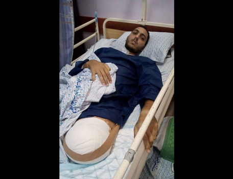غالب حمامي.. من المسؤول عن خسارته لساقه؟