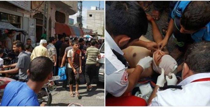 صور| شاب يطعن بائع بطيخ برأسه ويصيبه بجراح خطيرة