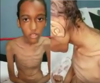 فيديو مؤلم| تعذيب وتجويع طفل في السعودية بشكلٍ وحشيّ لمدة عامين!
