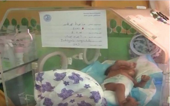 فيديو| الطفل السمكة ولد في لبنان!