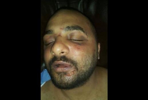 خطفوا "بادي جارد" من أحد النوادي الليلة ثم عذبوه وتبولو في فمه وأعتدو عليه جنسياً ورموه بمنتصف الشارع عارياً