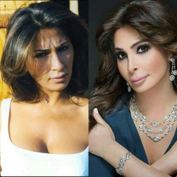 صور صادمة .. فنانات عرب قبل وبعد عمليات التجميل !