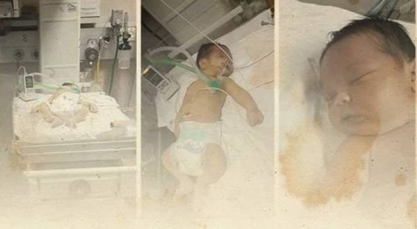 وفاة الرضيع محمد أبو عون نتيجة خطأ طبي بمستشفى الشفاء