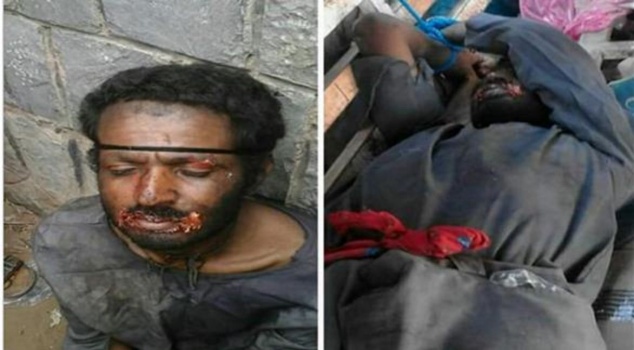 أجهزة الأمن اليمنية تنجح في القبض على 'مصاص دماء' بعد مطاردة استمرت أسبوع