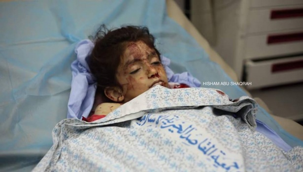 استشهاد طفلة دهسها مستوطن في بيت لحم