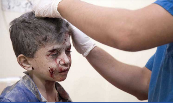 روسيا والنظام يعملان على توسيع استراتيجية «الجوع حتى الركوع» إلى حلب… أسلحة فتاكة واستهداف المدنيين وقوافل الإغاثة وحرق ما تبقى منها