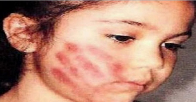لماذا نهانا الرسول محمد عليه الصلاة والسلام عن الضرب على الوجه؟