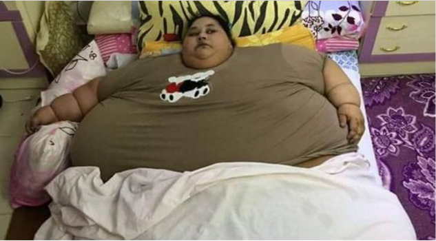 مصرية وزنها نصف طن ولم تخرج من منزلها منذ ربع قرن