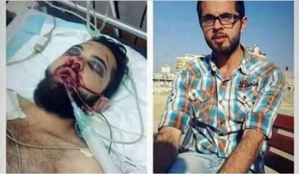 حادث سير ادخله في غيبوبة كاملة منذ عامين بعد ان كان متجهاً الى حفل تخرجه