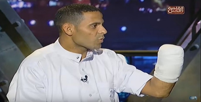سائق توك توك : البلطجية قطعوا كف يدي ورموه لكلب ! (فيديو)