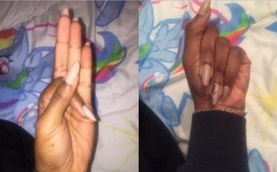 صورة غريبة ليد فتاة تثير الدهشة على تويتر.. فما قصتها؟
