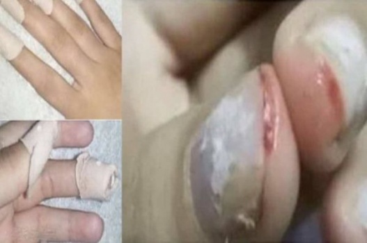معلمة تقتلع أظافر طالبة في احدى المدارس