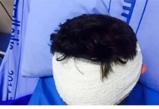 في الضفة.. 6 شبان يعتدون على طبيب