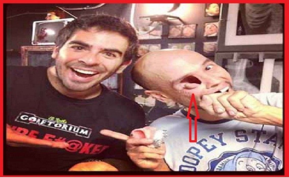 لن تصدقوا كيف خسر هذا الرجل عينه!