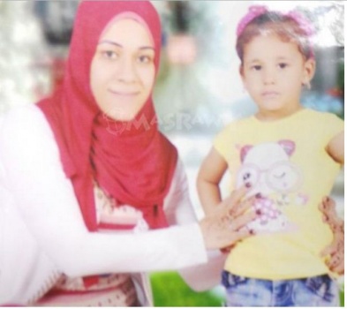 بالصور.. دافعت عن شرفها فحرقها شقيق زوجها بـ"الزيت المغلي"