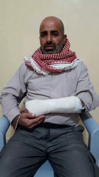 مستوطنون يعتدون على مواطن من الساوية جنوب نابلس