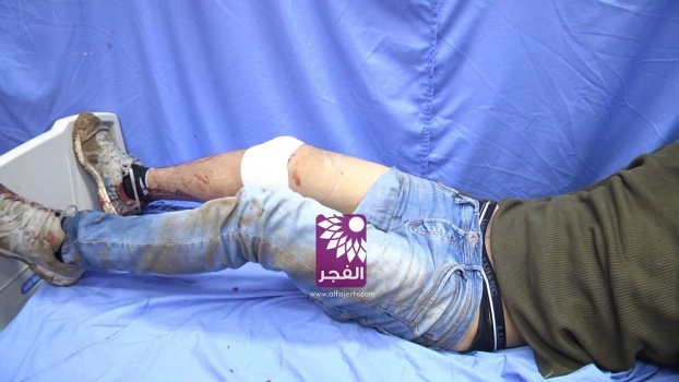 إصابة شاب برصاص الاحتلال على حاجز جبارة جنوب طولكرم