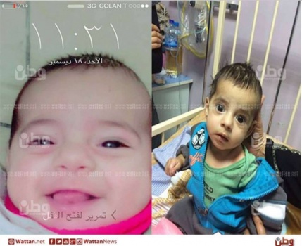 الرضيع حسن، يفقد السمع والبصر بعد علاج في مشفى حكومي