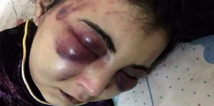 لإنها أنشأت صفحة على فيسبوك شاهدوا ماذا فعل زوجها بها!!!