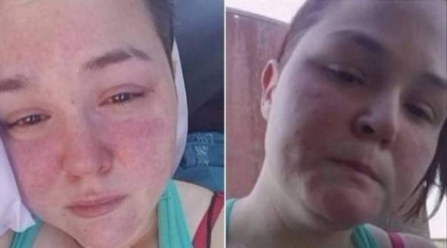 بعد أن ضاعت خمسة أيام في الصحراء.. هذا ما فعلته لتتمكن من النجاة!