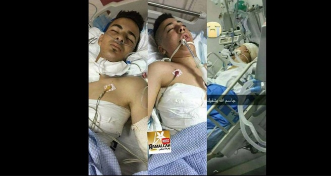 نقل الفتية المصابين بمجزرة الجلزون الى مشافي الداخل المحتل بسبب خطورة وضعهم