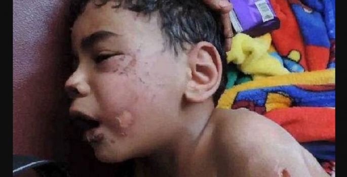 أحرق طفل زوجته ونزع أظافره.. والصدمة لم تأت بعد!