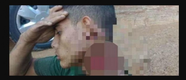 بالفيديو/ حمل رأسه شبه المقطوع مئات الأمتار بعد شجار مع عصابة!