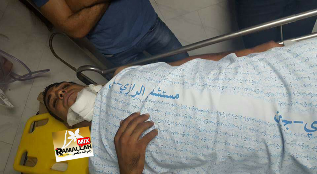 جنين: اصابة شرطي مرور بحادث تصادم خلال ملاحقته مركبة مخالفة