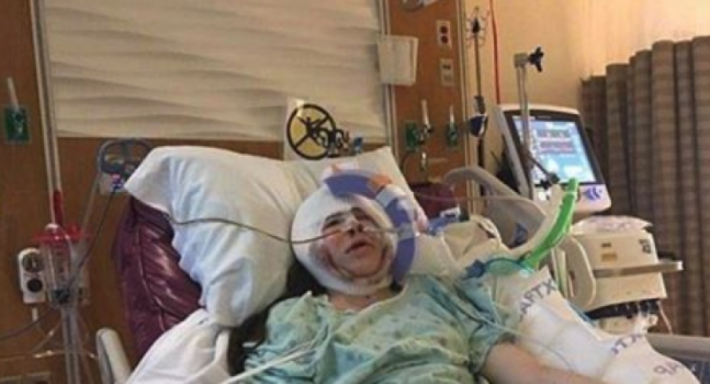 إيفانكا ولدت بوجه غير مكتمل.. شاهدوا كيف أصبحت بعد التجميل!