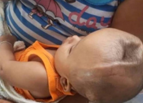 تخلى عنه والداه بعد ولادته.. وكيف تصف الجدة معاناة حفيدها؟