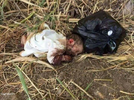 فيديو مروع : العثور على رضيعة مجهولة الهوية قرب مزبلة وقد أكلت القوارض يدها ونهشت جسدها !