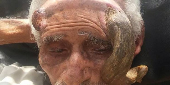 فيديو| هل تذكرون المعمِّر صاحب 'القرن'..هكذا تسبّبوا بقتله بوحشية لا توصف!