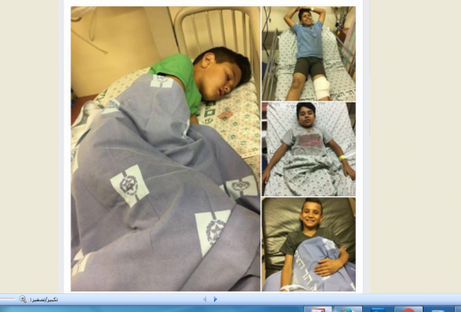 اهالي اطفال سلوان يطالبون شرطة الاحتلال بالتحقيق بدهس ابنائهم