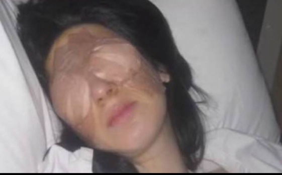 مرض نادر وغريب.. عينا هذه المرأة تقفلان 3 أيام متتالية!