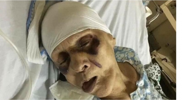 مسنة مصرية عذبها ابنها حتى الموت إرضاء لزوجته