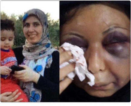 " تفاصيل " قصة السورية التي شوهها زوجها بحادثة هزت البحرين