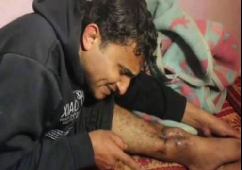 المشوخي بعد تهديد الاطباء بقطع رجله وصل عمان وتناول وجبة &ldquo;منسف بمبادرة من اهالي المخيمات