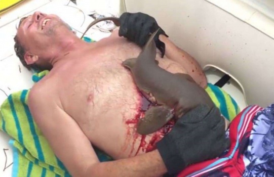 شاهد.. قرش يغرز أسنانه متشبثاً ببطن رجل حتى الرمق الاخير!
