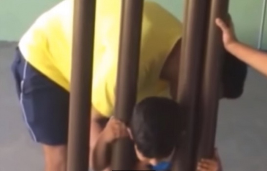 أب حاول تحرير رأس طفله من بين عمودين لساعتين.. وفشل!