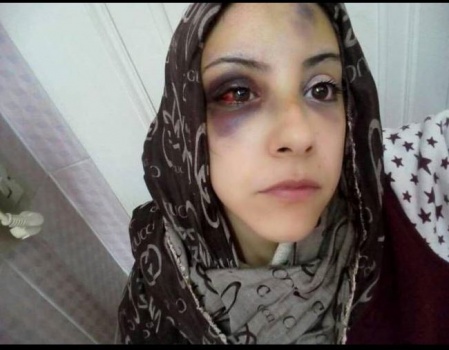 صور| جرّها في وسط الشارع وضربها بمساعدة والدته وإخوته.. والسبب!