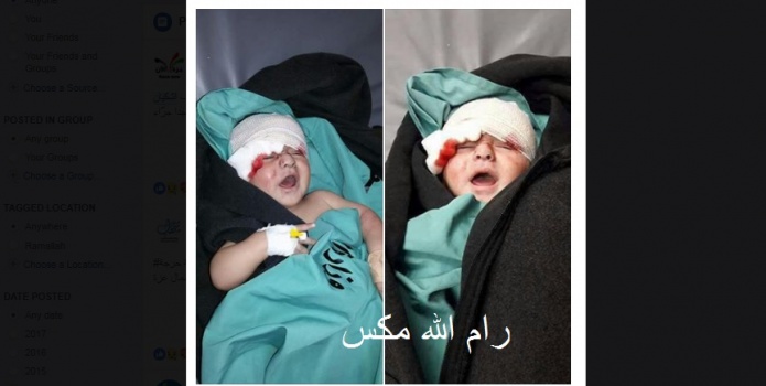 وزارة الصحة:  الرضيع يوسف إشكيان بحالة مستقرة، ونقلنا والدته الجريحة لمجمع الشفاء بجانبه