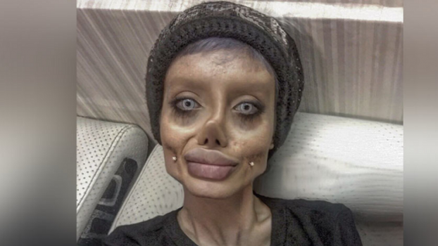 50 عملية تجميل كي تبدو مثل أنجيلينا جولي