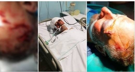 ابنٌ تخونه الرحمة... هشّم جمجمة والده من أجل 600 دولار!