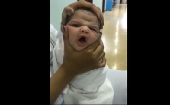 فيديو.. ممرضات يعبثن بوجه رضيع وصحة الطائف تتحرك