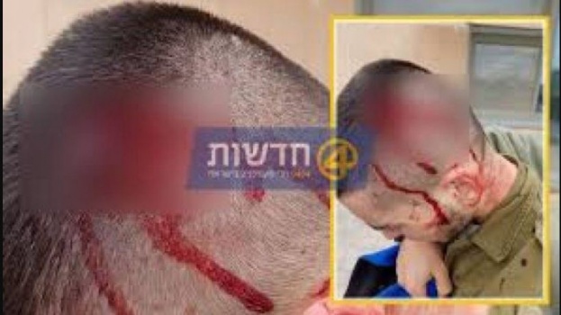 إصابة 11 جنديًا إسرائيليًا في شجار بقاعدة عسكرية