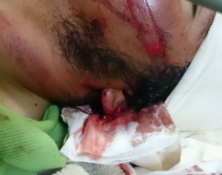 مستوطنون يعتدون على شاب ووالدته