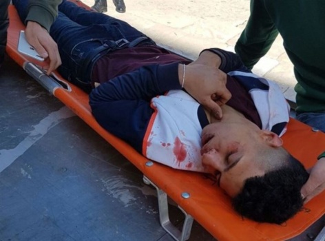 فيديو وصور :مستوطنون ينهالون بالضرب المبرح على مقدسي