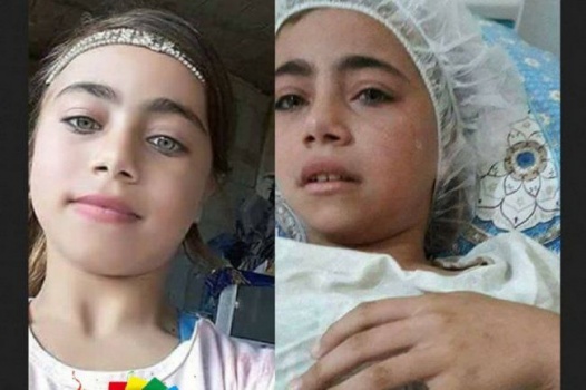 بعد ضغوط.. الاحتلال يسمح لوالدة الطفلة انعام المرور عبر "ايرز" لمرافقتها في العلاج