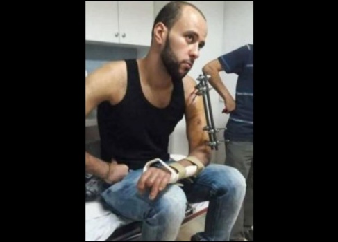 جنود الاحتلال اعتدوا على مصاب خلال اعتقاله