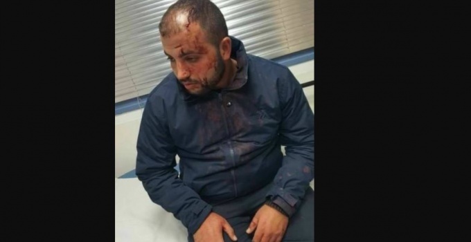 مستوطنون يعتدون بالضرب المبرح على الشاب صلاح ابو جمل